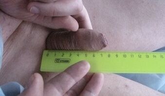 misurazione della dimensione del pene
